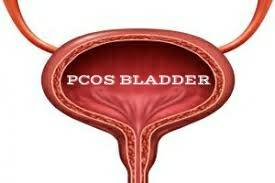 High testosterone levels associated with #PCOS may cause increased urinary urgency, incontinence and a need to urinate at night.
