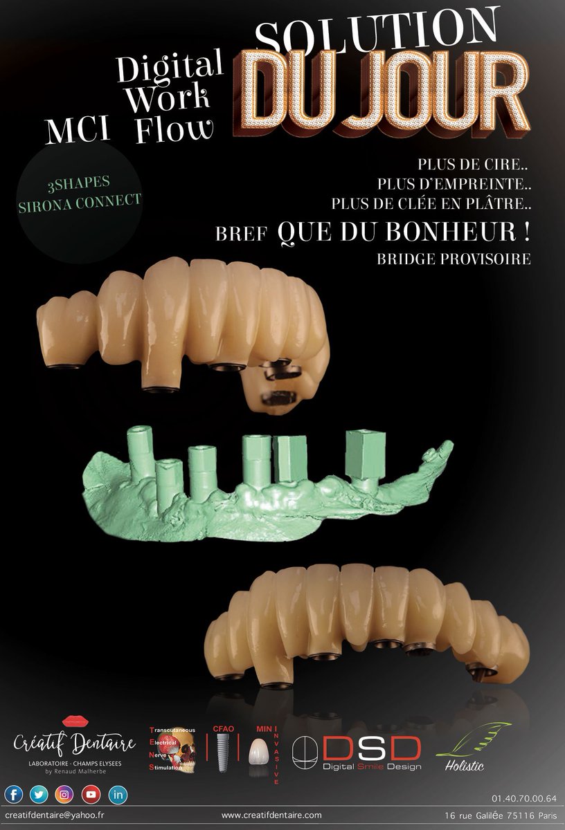 RenaudMalherbe's tweet photo. La solution du jour ! #sirona #3shapes #implants #dentisterie #creatifdentaire #solutiondujour #MardiConseil https://t.co/YQLhr97l8S