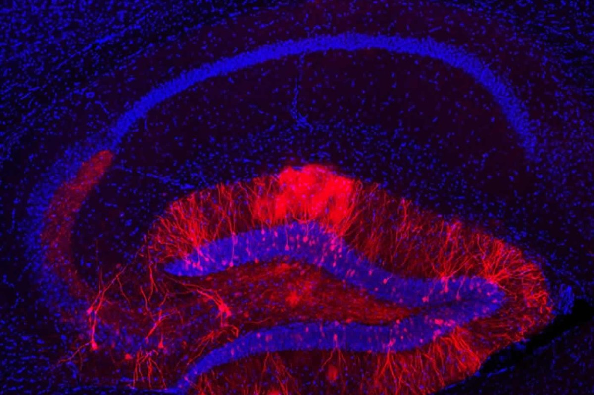 NeuroscienceNew tweet picture