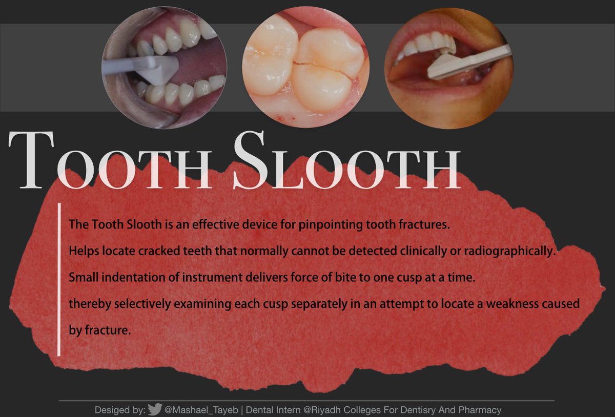 mashael_tayeb's tweet photo. What is #Tooth_Slooth ? 🤔
#RCsDP #RCDP #كليات_الرياض #SLDE #SLE https://t.co/zJBRts1ot6