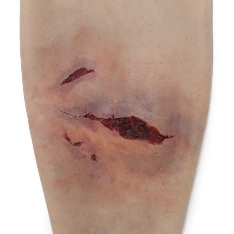 SIMBODIES's tweet photo. @TraumaFXUK amazingly realistic #simsleeves are wearable, quick &amp; consistent method for creating simulated injuries on #simbodies, #actors https://t.co/fsxbmDP9qX