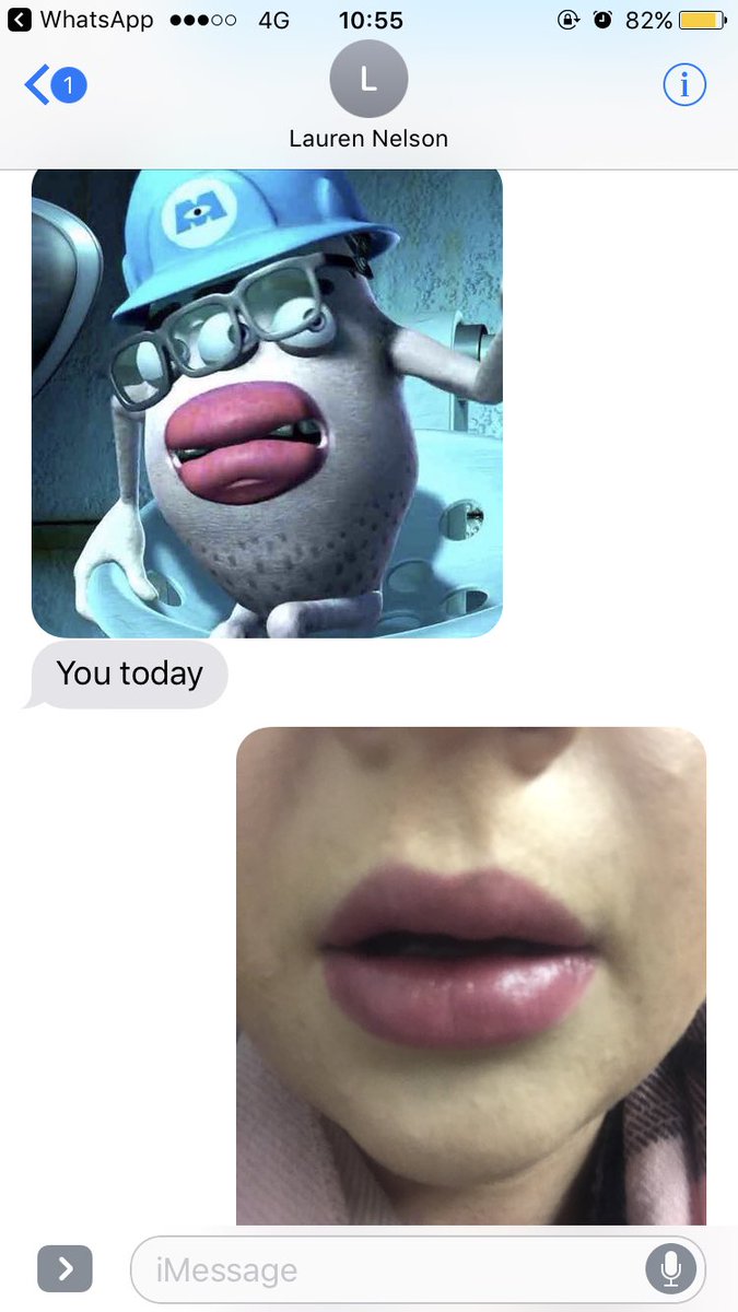 Top lip swollen to fuck and lauren describes me as something from monsters  inc 🙃