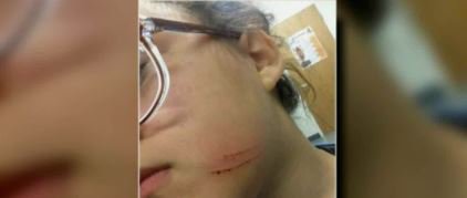 Orange County teacher fired after girl hit in face by flying scissors bit.ly/2yNvd2A?source… https://t.co/jCdj2Z0NOh