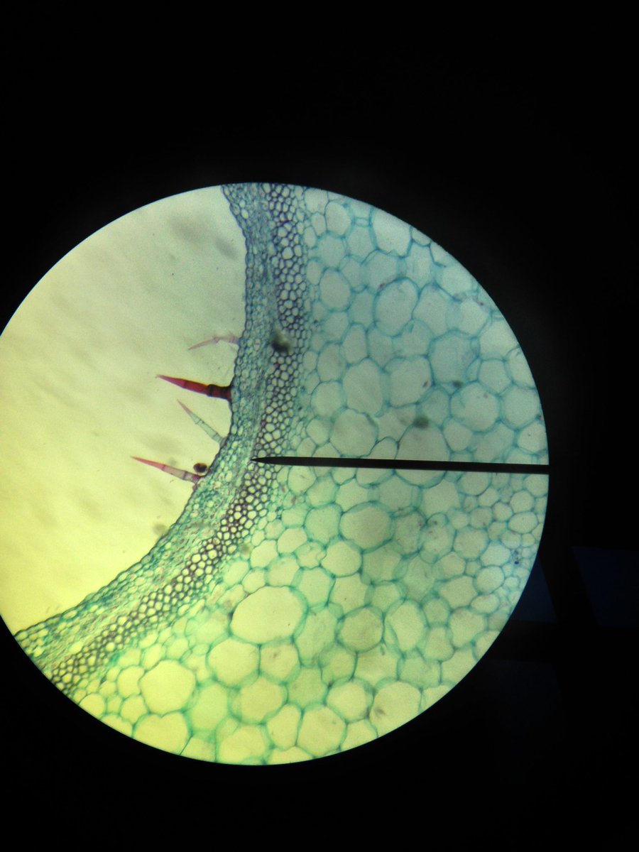 j11p43f's tweet photo. Stem trichomes stained in red
#MicroscopeScience #PlantsAreCool #BiologyIsAwesome https://t.co/mdklSTvaaS