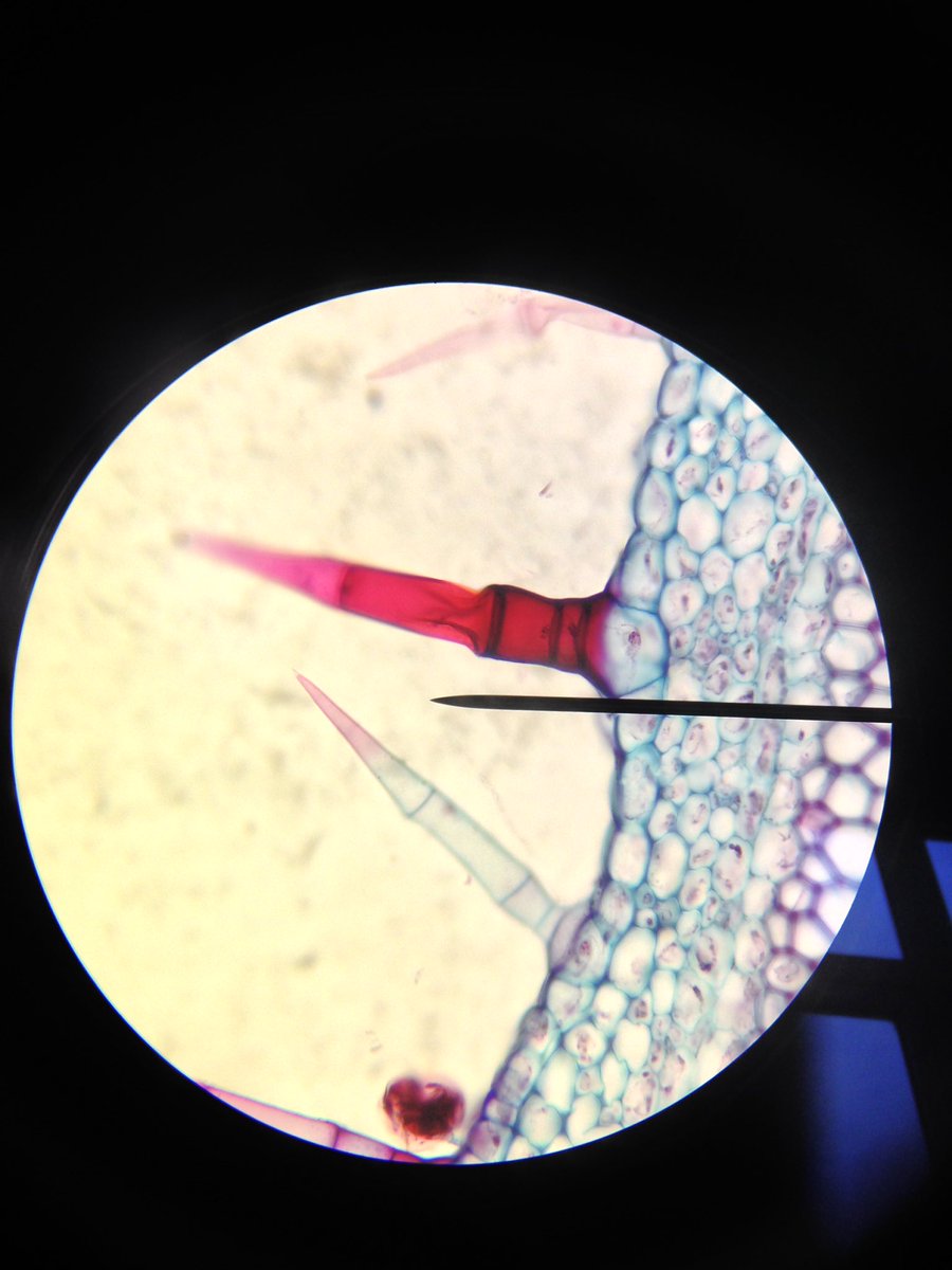 j11p43f's tweet photo. Stem trichomes stained in red
#MicroscopeScience #PlantsAreCool #BiologyIsAwesome https://t.co/mdklSTvaaS