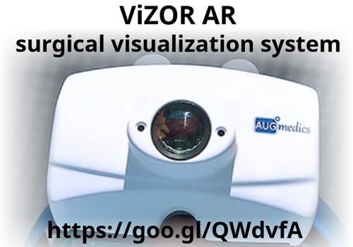 MedGizmo's tweet photo. #augmedics ViZOR #AR #surgical #visualization system https://t.co/w3yV9fulXp HealthTech #HealthIT #AR #VR #MR #VRtech #spine #surgery https://t.co/2PQNEeQtM4