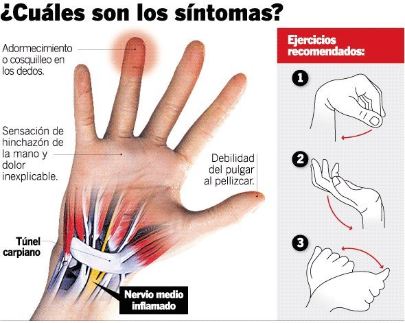 Uzivatel Cgcfe Na Twitteru Adormecimiento Y Cosquilleo En Los Dedos Sintomas Del Sindrome Del Tunel Carpiano Compartimos Esta Infografia Via Equipodelatorre Https T Co S9q4djvock Twitter Uzivatel Cgcfe Na Twitteru Adormecimiento Y Cosquilleo En Los Dedos Sintomas Del Sindrome Del Tunel Carpiano Compartimos Esta Infografia Via Equipodelatorre Https T Co S9q4djvock Twitter