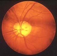 proeyecareja tweet picture