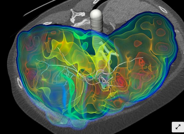 jadeshiro's tweet photo. Do not miss to vote! #RSNAImageContest #sciart #artsci #medicalimaging @FraunhoferMEVIS
https://t.co/fWOAqrHm22 https://t.co/qvUqr6YjBw