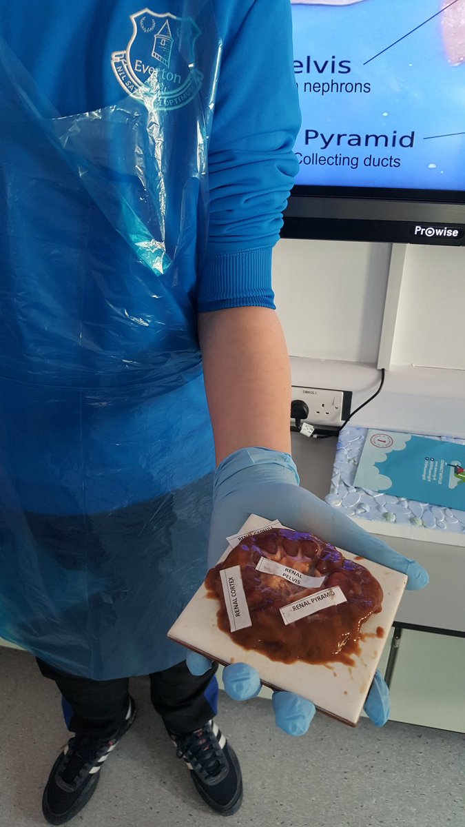 EvertonSchool's tweet photo. Making the Endocrine System fun! #kidneydissection . https://t.co/2Ats4yFRYQ