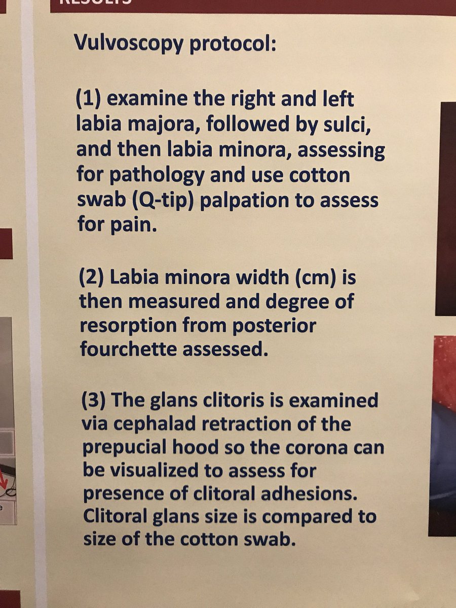 PelvicPainOrg's tweet photo. Great posters from Dr Irwin Goldstein, heralding need for all PTβs to use vulvoscopes to assess progress in patients w vulvar pain! #WCAPP17 https://t.co/2lp5maBoGr