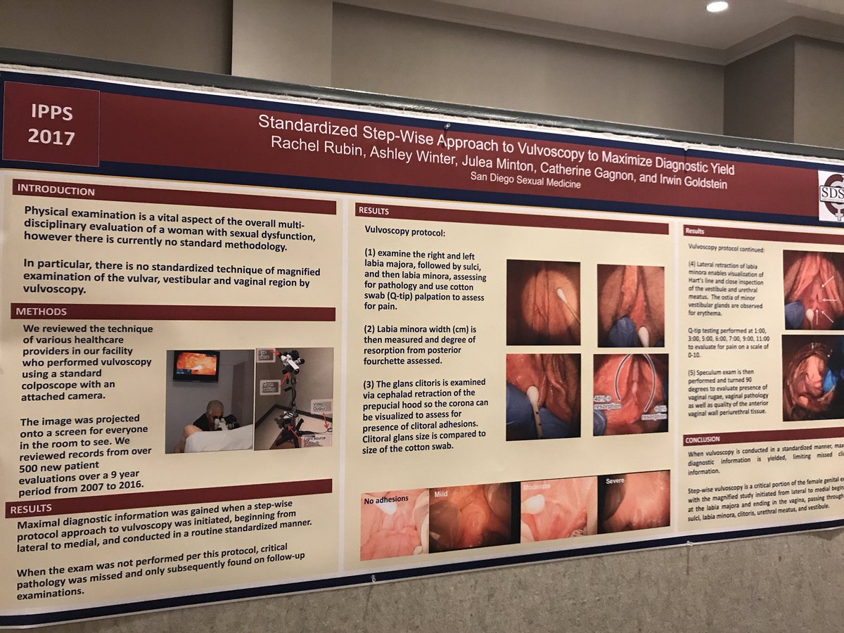 PelvicPainOrg's tweet photo. Great posters from Dr Irwin Goldstein, heralding need for all PTβs to use vulvoscopes to assess progress in patients w vulvar pain! #WCAPP17 https://t.co/2lp5maBoGr