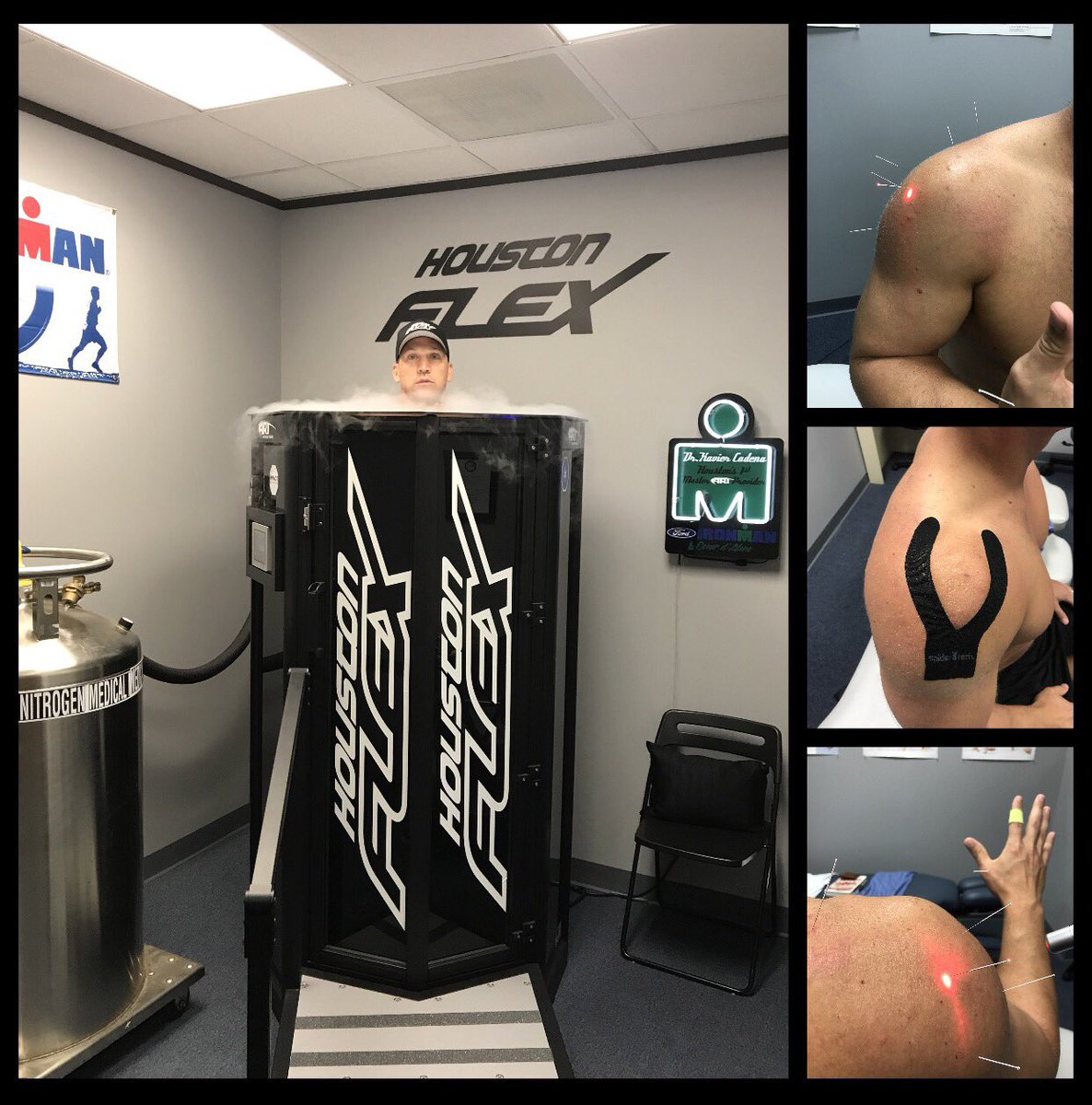 Combing a few minutes of soft tissue mobilization (ART), Acupuncture with Cold Lazer Stim and producing excellent results!! #HoustonFlex