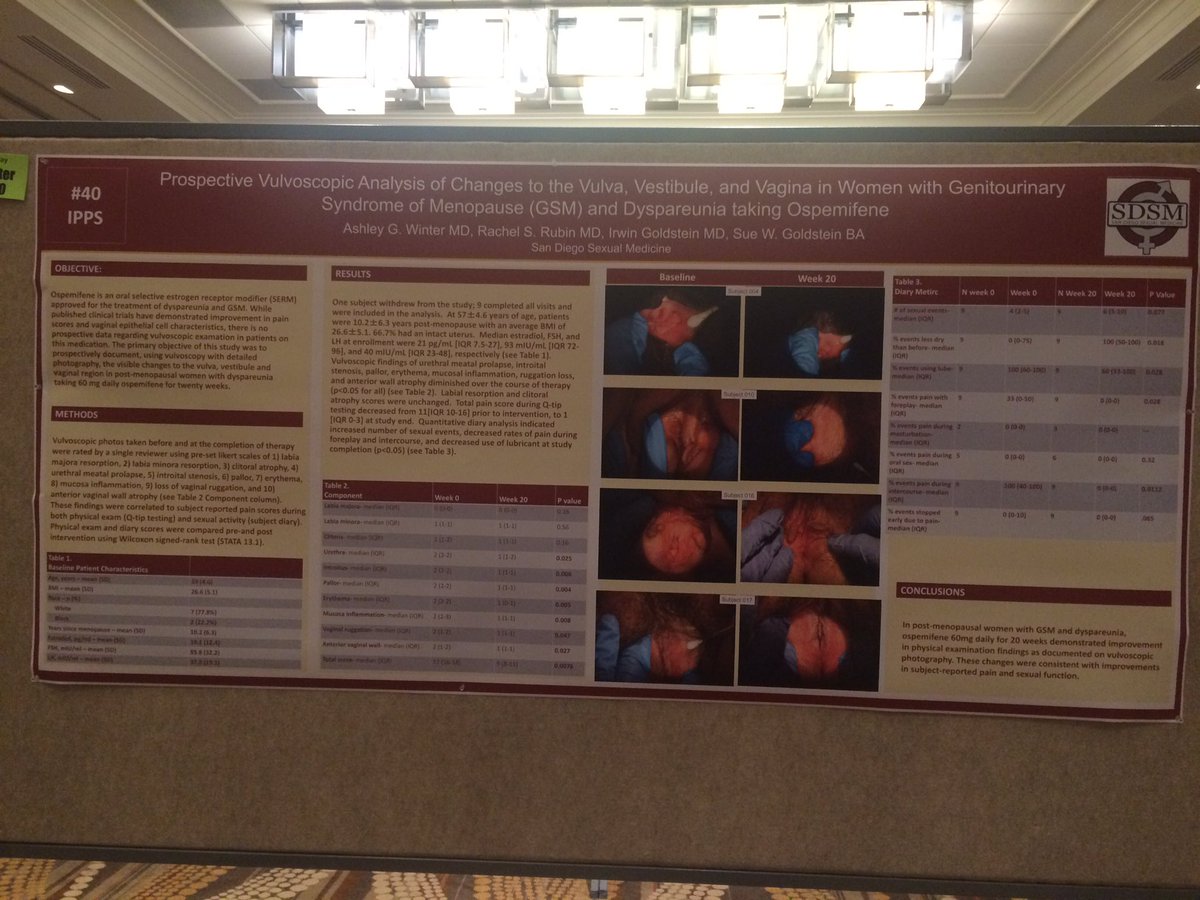 drrachelrubin's tweet photo. Check out our research at #IPPS17 #vestibulodynia #vulvoscopy #vestibulectomy @SDSexualMed @JamesASimonMD https://t.co/z6mq5nWhGY