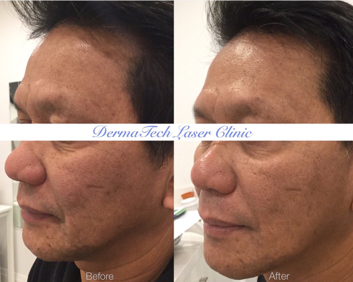 derma_tech tweet picture