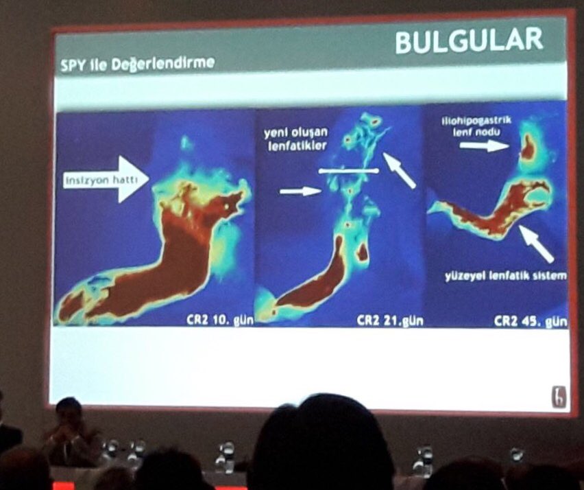 cerrahitv's tweet image. 39.Türk Plastik Rekonst. Ve Estetik Cerrahi Kurultayı  Deneysel Araştırma Birincisi @HacettepeTip Plastik Cerrahi @tiskmcv @NOVADAQTech #SPY