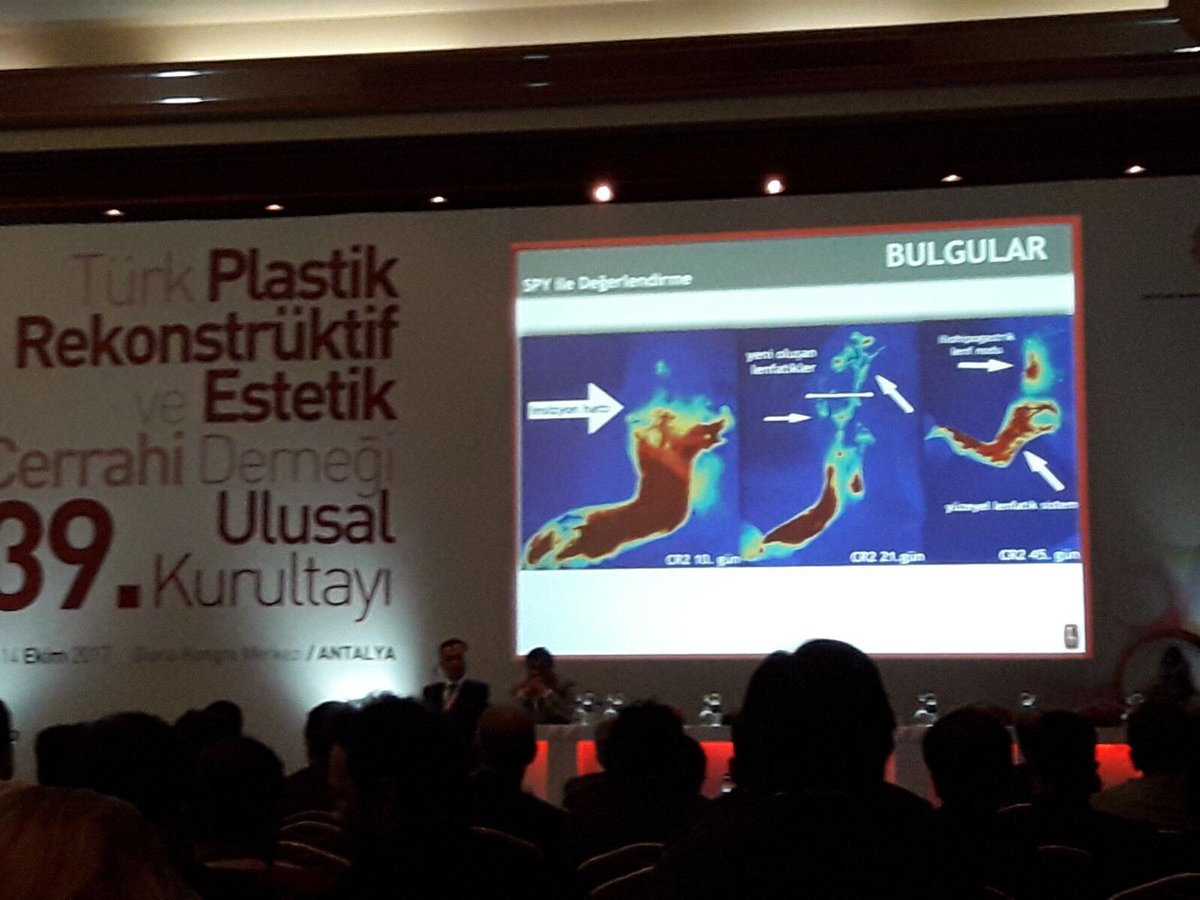 cerrahitv's tweet image. 39.Türk Plastik Rekonst. Ve Estetik Cerrahi Kurultayı  Deneysel Araştırma Birincisi @HacettepeTip Plastik Cerrahi @tiskmcv @NOVADAQTech #SPY