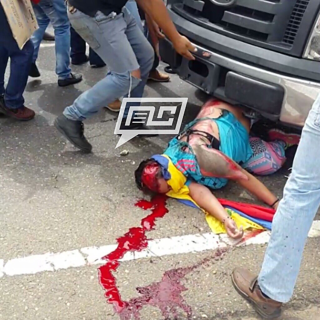 JESUSESA's tweet photo. ¡ENHORABUENA! Oriana Wadskier a 5 meses de su horrible atropello, que sufrió adrede en Calabozo el 9May ¡Gracias a Dios hoy SONRÍE! llena de VIDA y en franca recuperación. 
Tenemos motivos para continuar! 
También quedaron ángeles en la tierra!
#VZLA será LIBRE! 
*A*M*E*N* #13Oct https://t.co/vMqHedYvKS