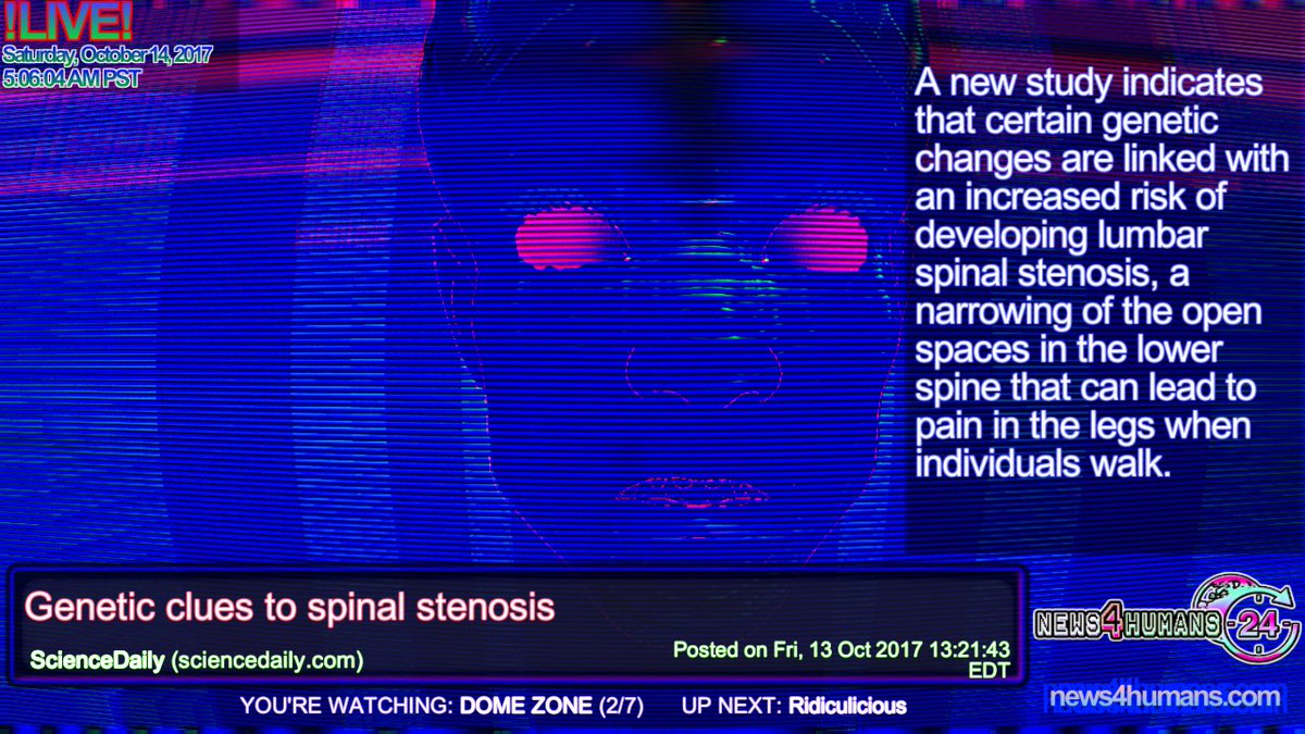 DOME ZONE via  ScienceDaily: Genetic clues to spinal stenosis sciencedaily.com/releases/2017/… #science