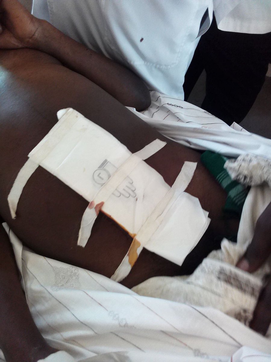 <a href="/Atwine_Diana/">Zemaz💎</a> <a href="/UgHealthcreFed/">Uganda Healthcare Federation</a> <a href="/MinofHealthUG/">Ministry of Health- Uganda</a> <a href="/HomeDoctorsUG/">Home Doctors Uganda</a> <a href="/KagutaMuseveni/">Yoweri K Museveni</a> <a href="/nbstv/">NBS Television</a> <a href="/Snduhukire/">Sheilla Nduhukire 🇺🇬</a> <a href="/ntvuganda/">NTV UGANDA</a> <a href="/jkkarungi/">Josephine Karungi</a> <a href="/RedPepperUG/">Red Pepper Uganda</a> 
Sad sad..