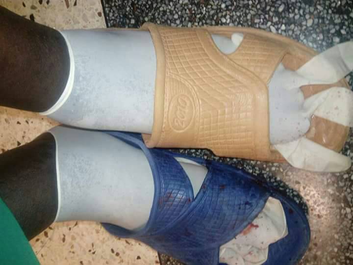 Ug doc improvising in a poor govt hospital to operate on a pregnant lady coz we #Doctorsarenoble, we patriotic Ugandans say #EnoughIsEnough