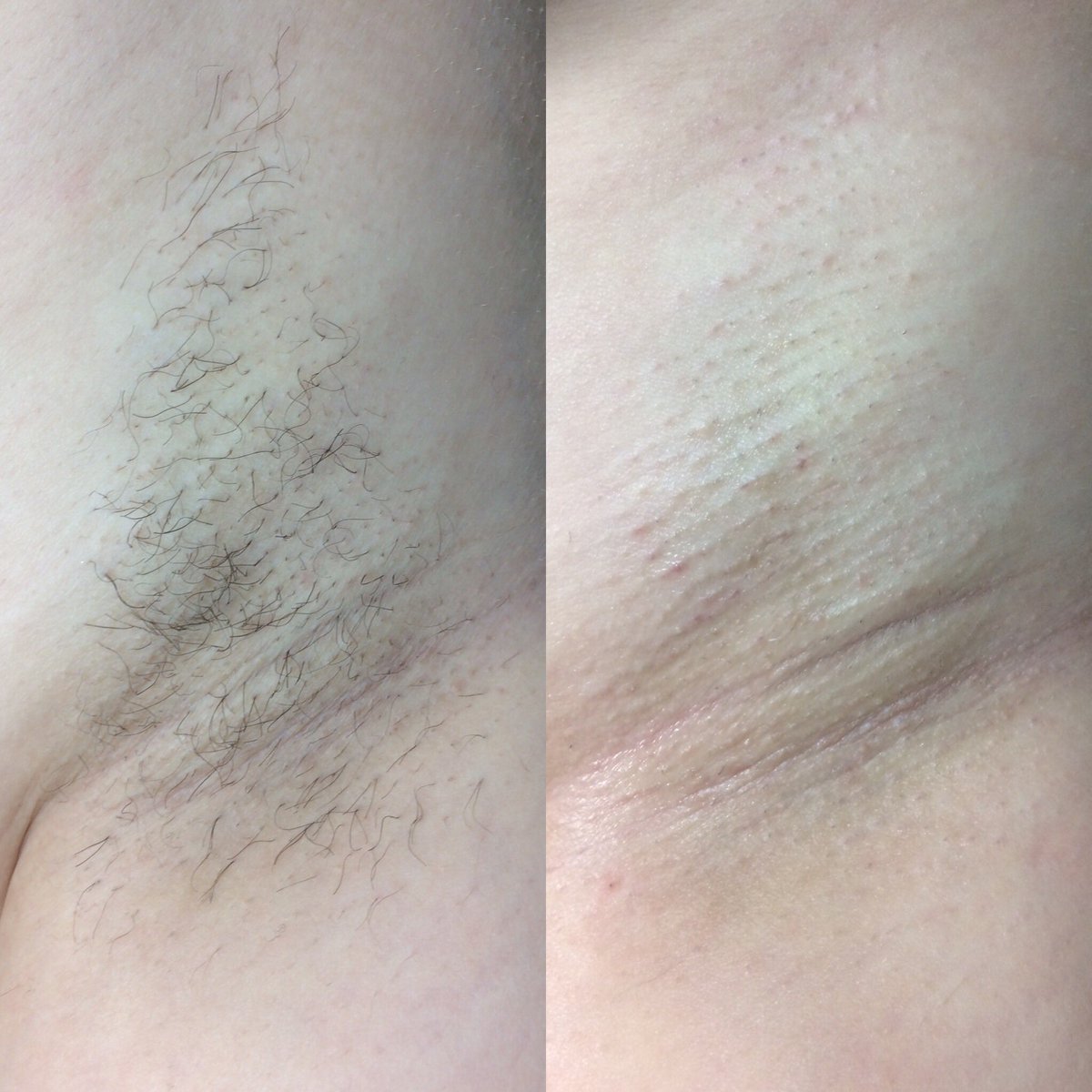 PenelopeSchool's tweet photo. Waxing courses are available, a must have for every beautician! #waxing #beauty #courses #PenelopeAcademy #PenelopeHairBeauty https://t.co/cNIHfsZjHO