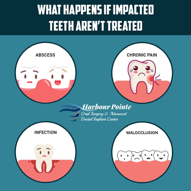 hporalsurgery's tweet photo. Don’t wait for #ImpactedTeeth to give you trouble. Get in touch with Harbour Pointe Oral Surgery today! #HPOralsurgery #DentalCare https://t.co/68IxzTr4Ms