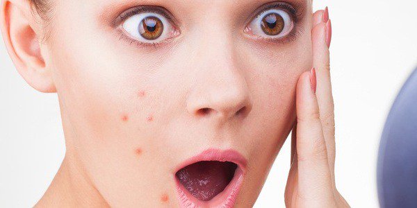 Complete Guide To Acne Treatment For Oily Skin Face [Step by Step] thehealthsign.com/acne-treatment…