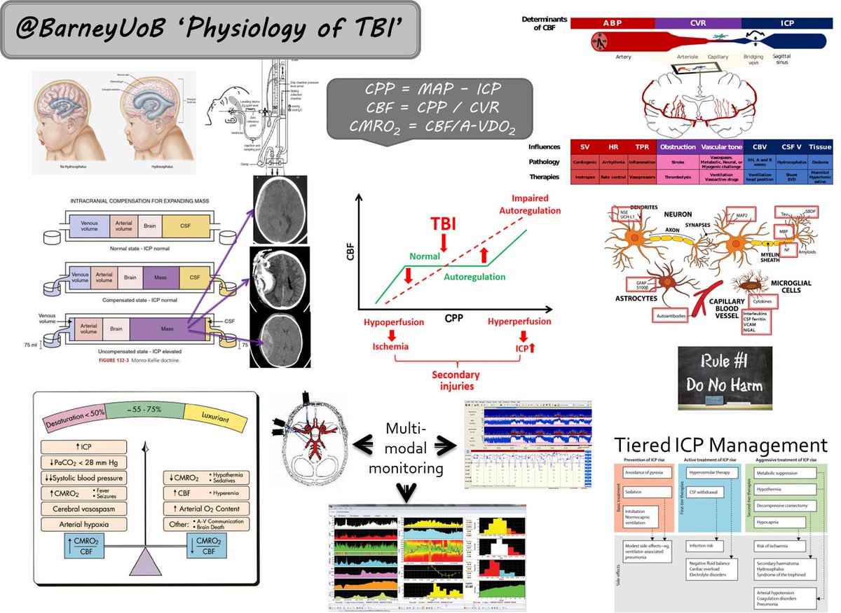 BarneyUoB's tweet photo. Paeds Tbi physiology in a page version 2! Higher Res pic hopefully! https://t.co/jkO0fikRSU