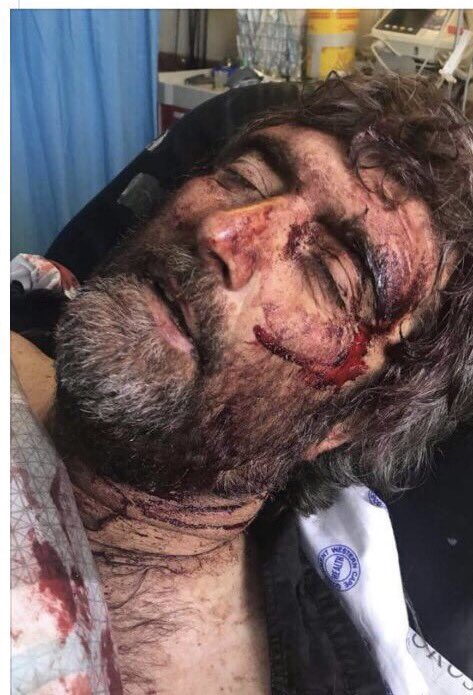 RT RT RT FARM ATTACK WANTED NOTICE: Here are the attackers who nearly killed Mr Van Der Merwe in Koue Bokkeveld, WC. Let's make them famous.