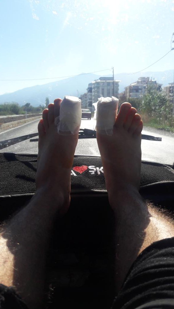 Ameliyatimizi  olduk  geçmiş  olsun  diyelim