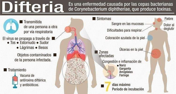 Sintomas del reuma en la sangre