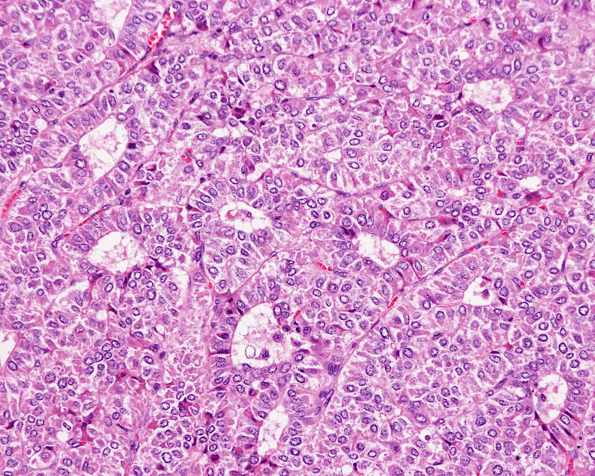 3d cell based biosensors in drug discovery programs microtissue engineering for high throughput