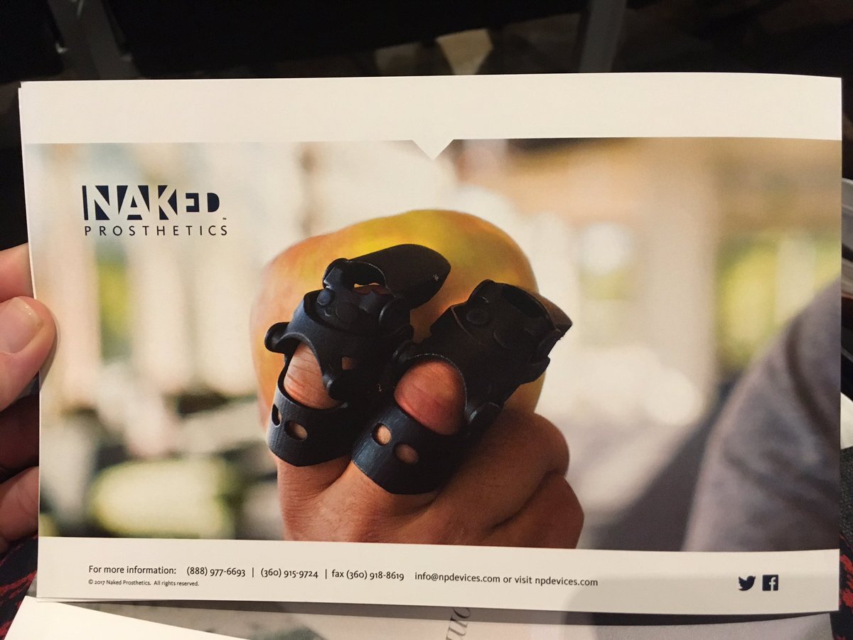 SandySublett's tweet photo. These @NPDevices are amazing ! Why did it take so long to invent these, and why aren't they standard? #asht2017 https://t.co/YMapyrf5Qu