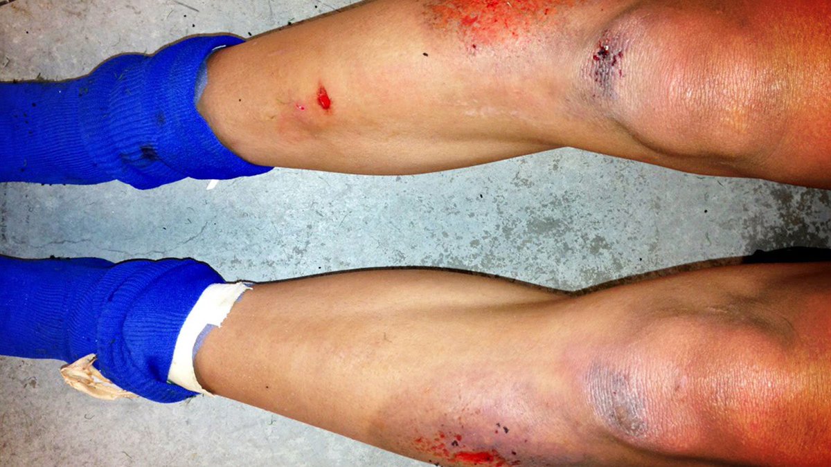turfqld's tweet photo. Artificial fake turf is Not environmentally friendly it causes personal damage, is hot and plastic. https://t.co/fCv2UPbc2H