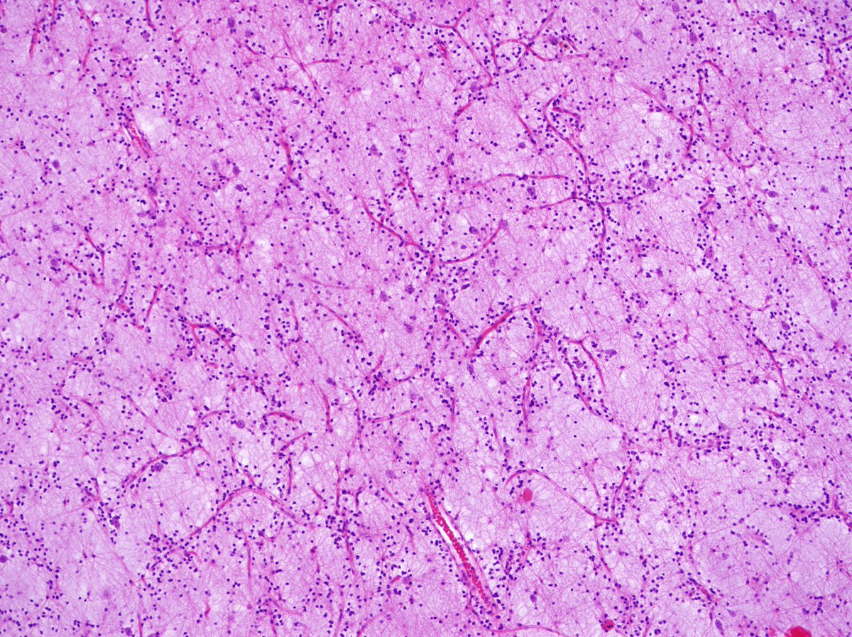 Pathology Walker@Auto Tweet Bot tweet media