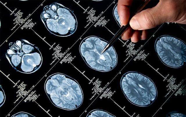 DoubleBondPharm's tweet photo. High safety profile for #Temodex according to #GLP-tox prestudy in vivo
https://t.co/ELCn2nNGXo
#drugdelivery, #braincancer, #innovation, #medicine #safety #glioma #GBM https://t.co/bqwLmZcLbT