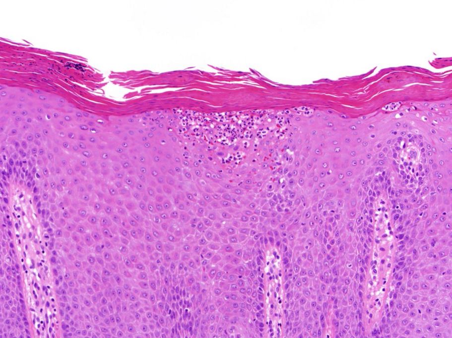 Pathology Walker@Auto Tweet Bot tweet media