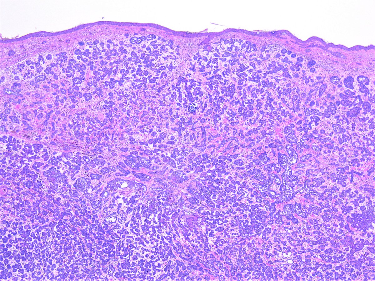 Pathology Walker@Auto Tweet Bot tweet media