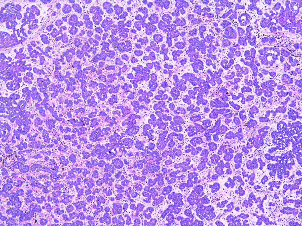 Pathology Walker@Auto Tweet Bot tweet media