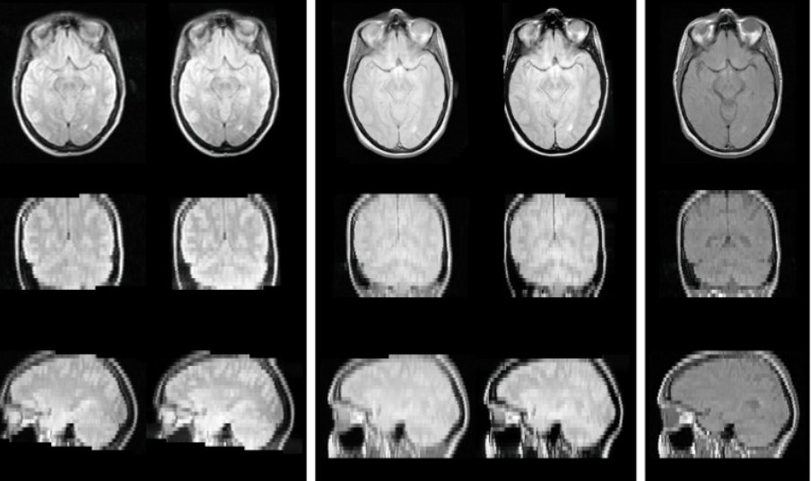 Volumetric MRI reconstruction from printed films
sciencedirect.com/science/articl…

A very-longitudinal study  the baseline scan was acquired in 1986!