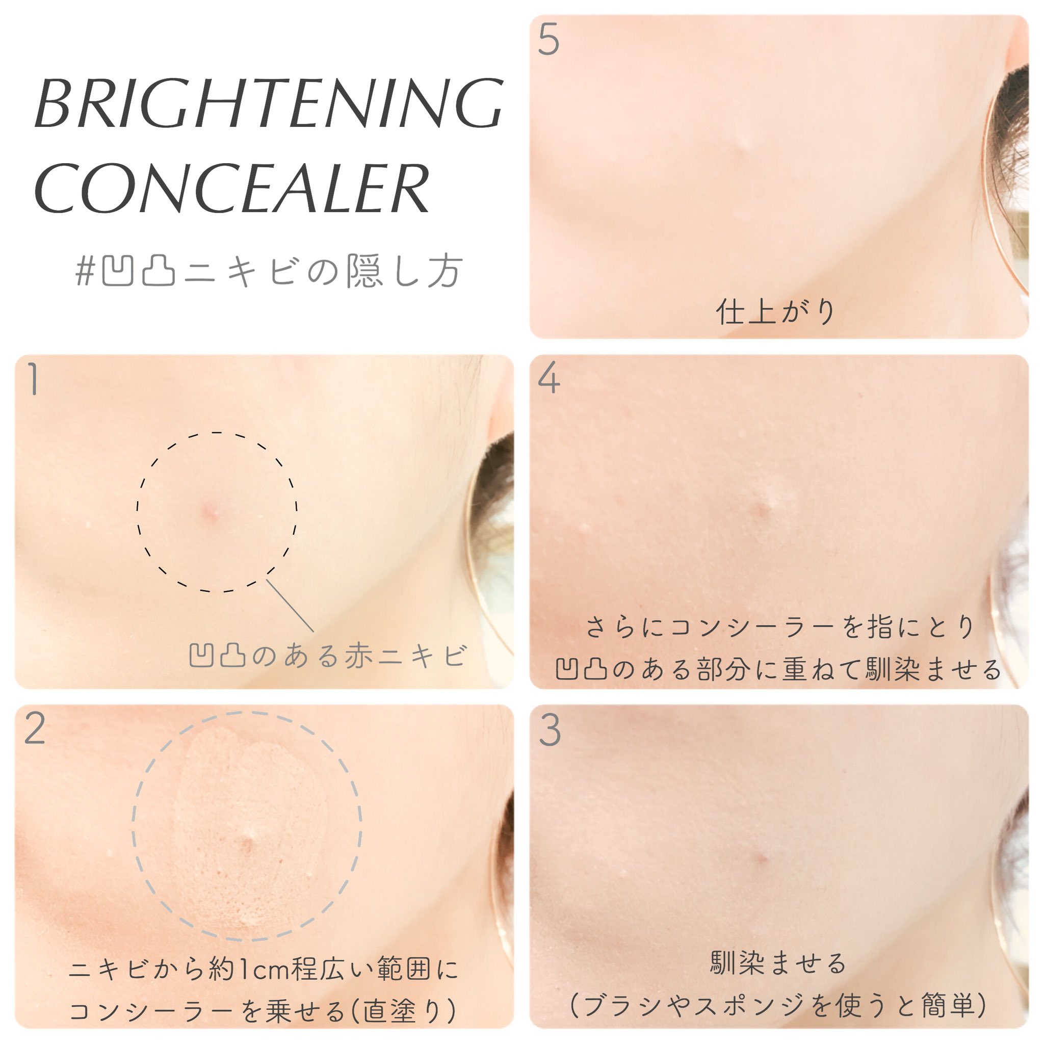 Blanche Etoile Shop 凹凸ニキビの隠し方 ニキビを含む少し広い範囲に コンシーラーをつける スポンジなどで馴染ませる さらにコンシーラーを指にとり 凹凸部分に重ねる 一度少し広い範囲にコンシーラーを馴染ませ 土台を作っておく事で次に Blanche Etoile Shop 凹凸ニキビの隠し方 ニキビを含む少し広い範囲に コンシーラーをつける スポンジなどで馴染ませる さらにコンシーラーを指にとり 凹凸部分に重ねる 一度少し広い範囲にコンシーラーを馴染ませ 土台を作っておく事で次に