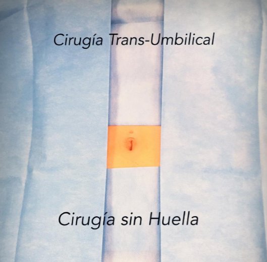 sinhuella's tweet photo. #CIRUGIASINHUELLA #Vesicula #Hernias #Apendicitis #CirugiaGeneral #CirugiaGinecologica #AgujasPercutaneas #CL1P #Imanlap #Imanes https://t.co/pJdRNXPyh2