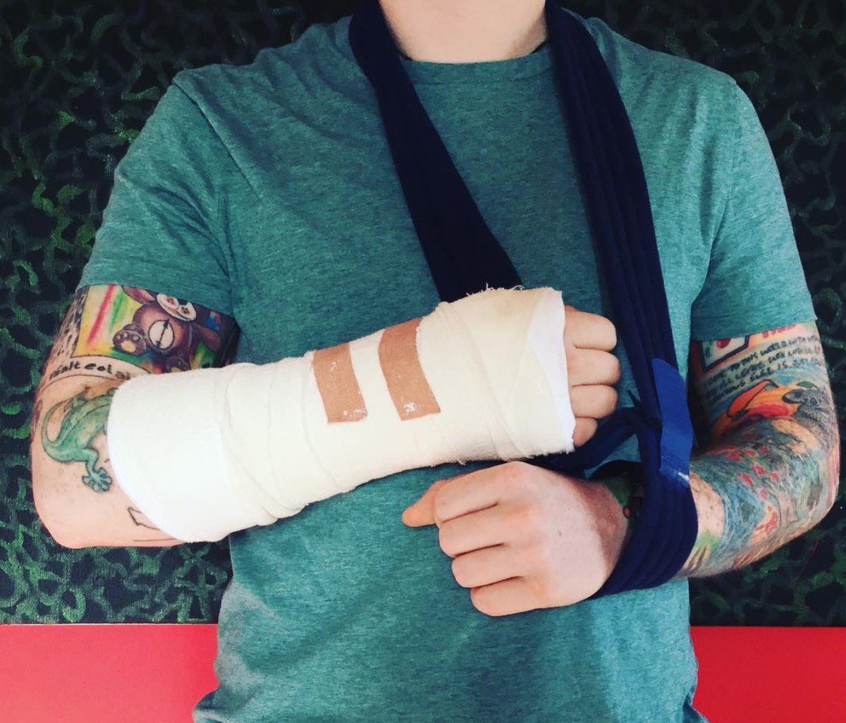 Ed Sheeran has broken his arm and his upcoming tour dates are in jeopardy >  bit.ly/2ypmrWe

#SmallzysSurgery 🎧