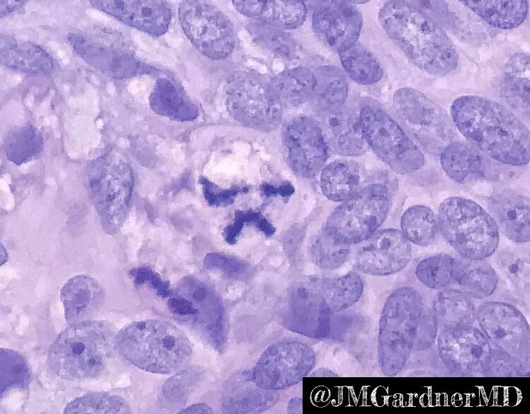 Jerad Gardner, MD tweet media