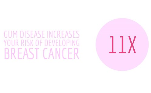 Isaveteeth's tweet image. Periodontists can help! Breast cancer is linked to periodontal disease. So we're offering free women's periodontal screenings all October.