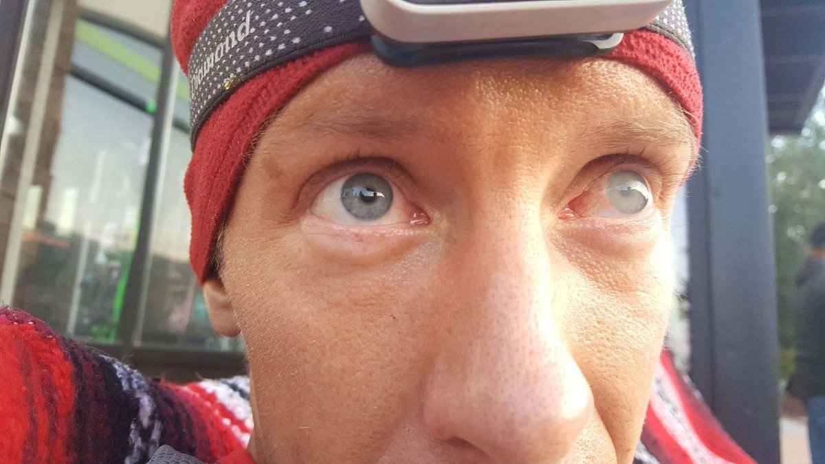 iRunFar's tweet photo. Temporary and painless vision loss during long ultramarathons, it's a thing. Learn more about it: https://t.co/RLA2SoUyij https://t.co/KtoEsViXmc