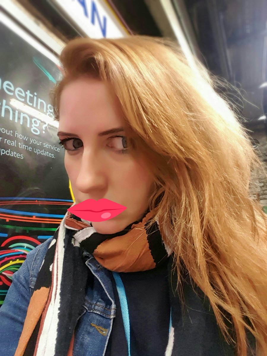 Had my lips done. Thoughts?
