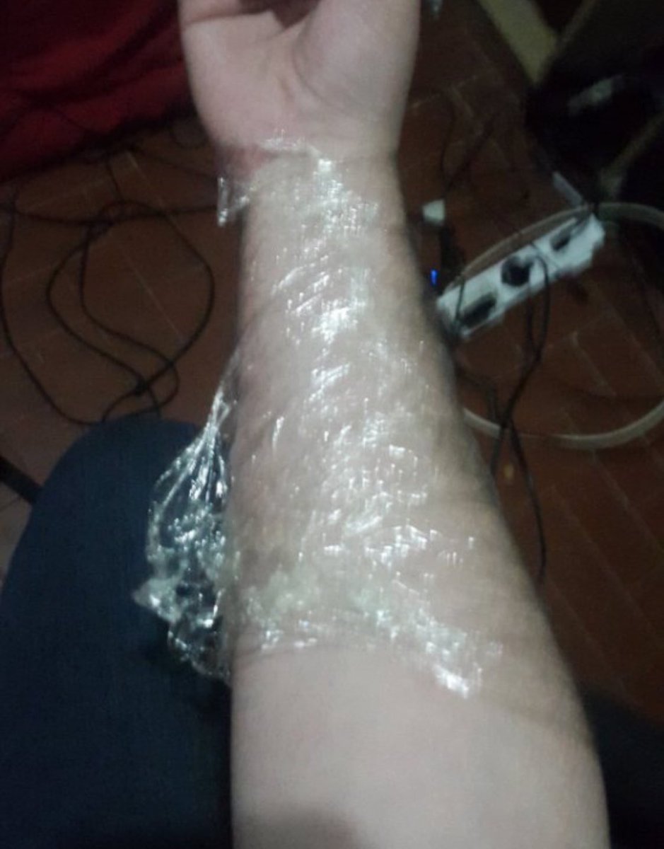 CatalanThings's tweet photo. Me he tatuado la democracia Española https://t.co/QLkGlJF4eg