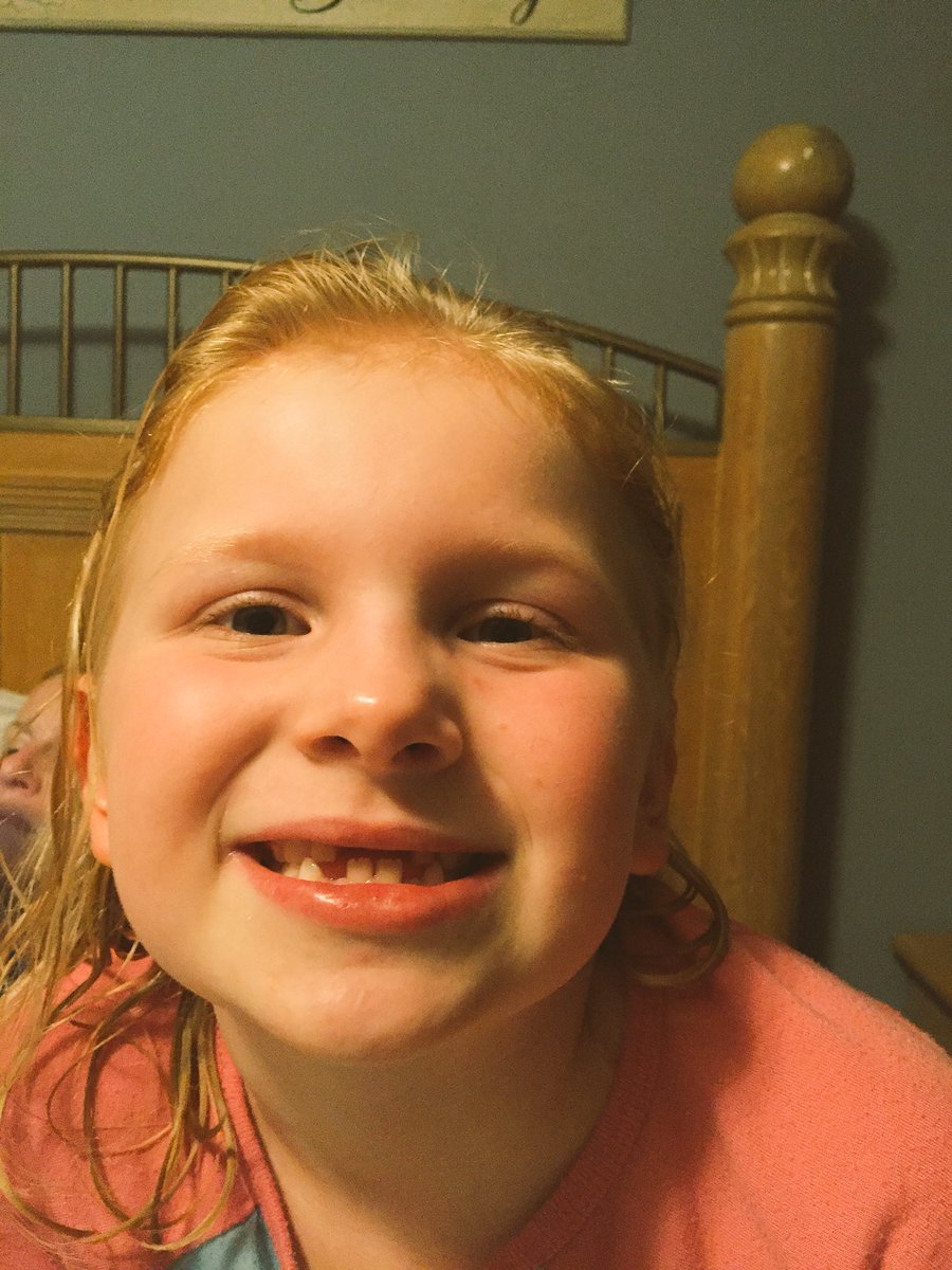 mr_szobocsan's tweet image. I guess we know what this little lady is going to want for Xmas! #2frontteeth #picturedayistomorrow